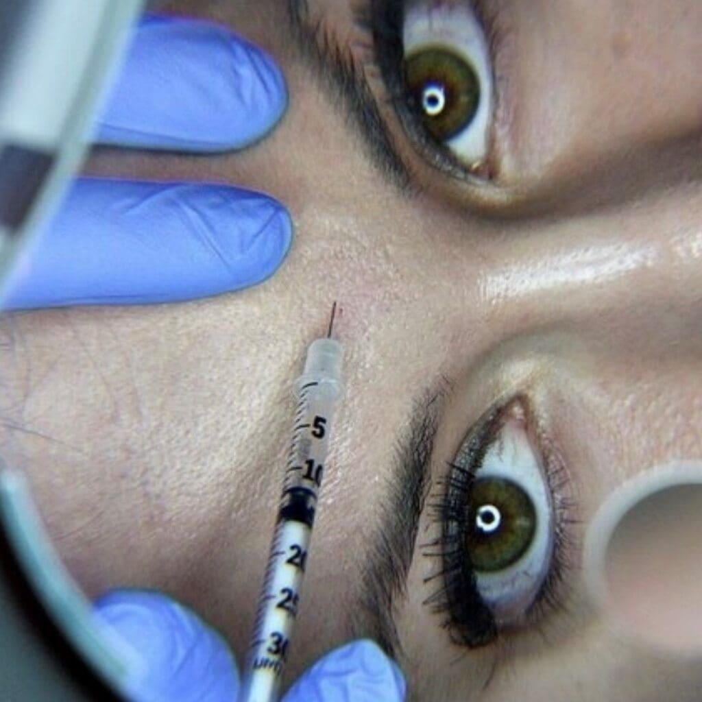 A person getting an injection in their face.