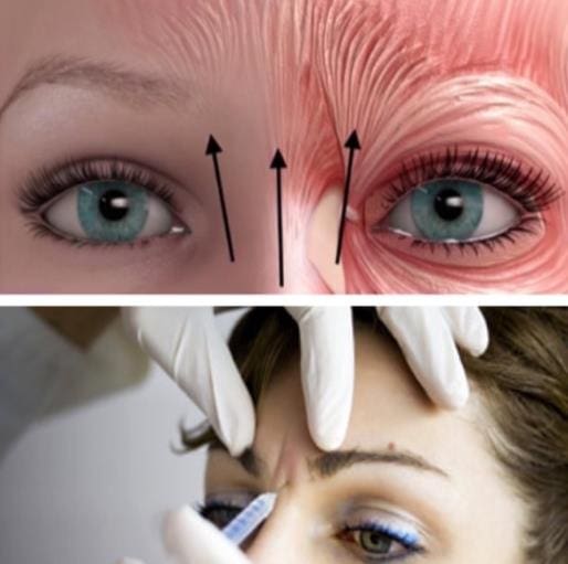 A woman with scissors and a needle in her eye.