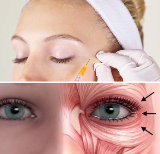 A woman with a medical mask on her face and an eye diagram