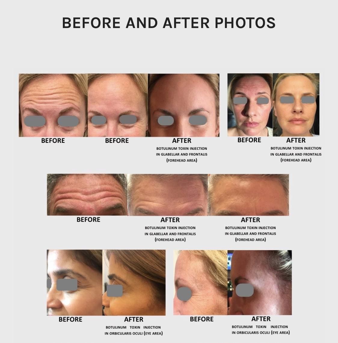 A series of photos showing before and after pictures of women 's face.