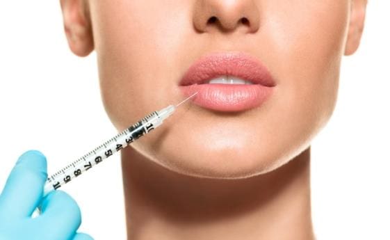 A woman is getting her lips filled with botox.