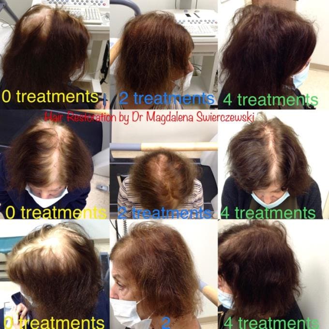 A woman 's hair is shown in different stages of treatment.