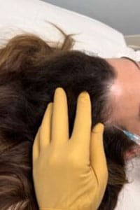 A person with yellow gloves on touching the head of another person.